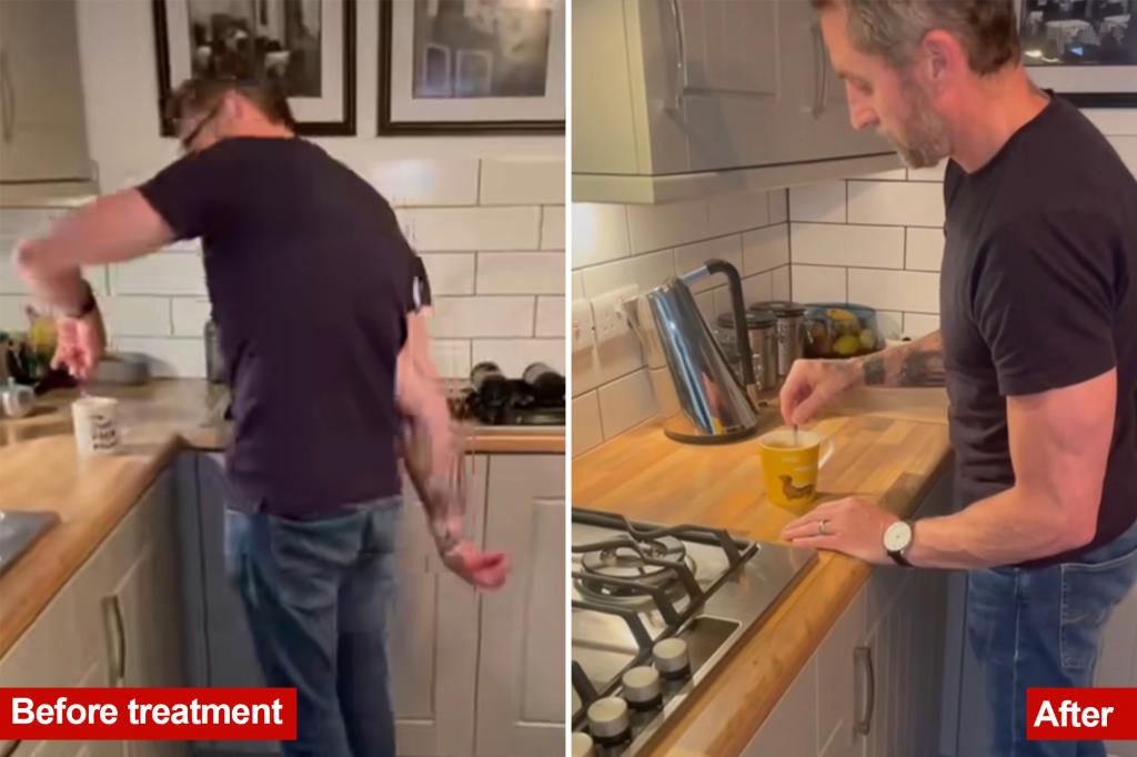 Shocking video shows UK dad with Parkinson's Damien Gath before and after taking latest drug: 'Life-changing'